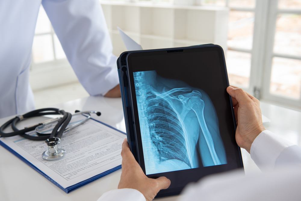 Fast Broken Bone and Imaging Services Near Falls Church Virginia