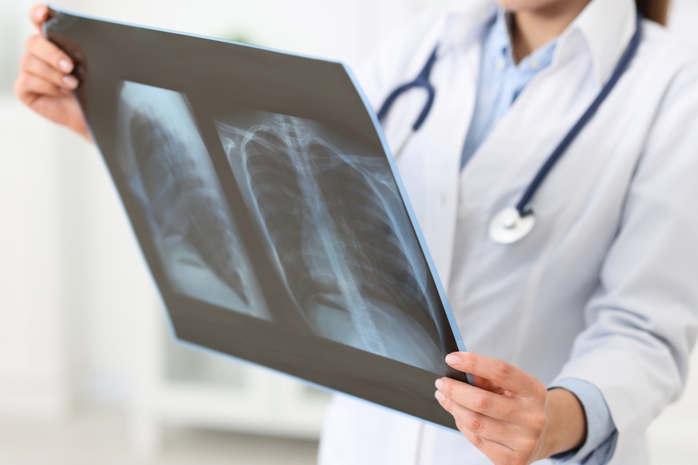 Broken Bone Evaluations and Digital X-Rays in Tysons Virginia Without the Wait