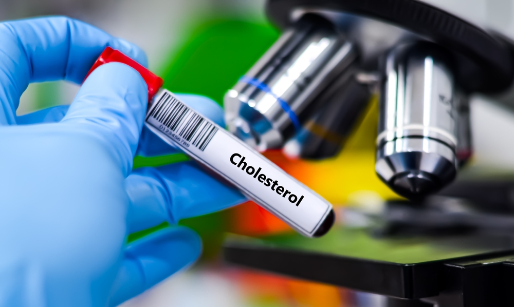 Top Primary Care Physicians in Reston Virginia for Cholesterol Checkups