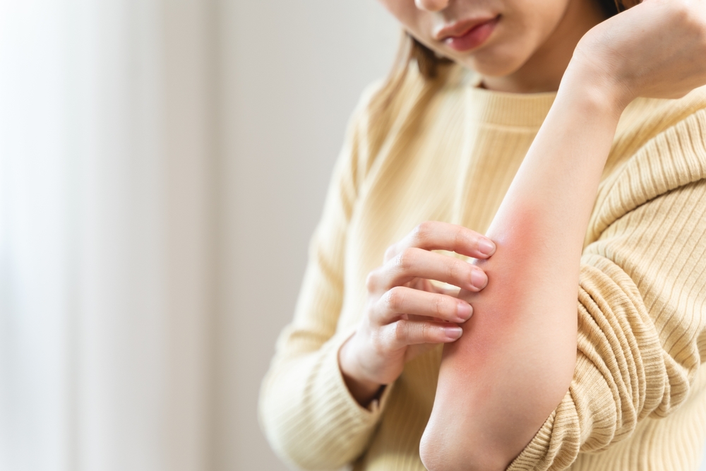 When You Should Schedule a Primary Care Consultation for Skin Rashes or Unexplained Itching in Reston, Virginia